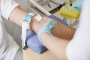 Blutabnahme nüchtern - Rauchen kann Werte beeinflussen