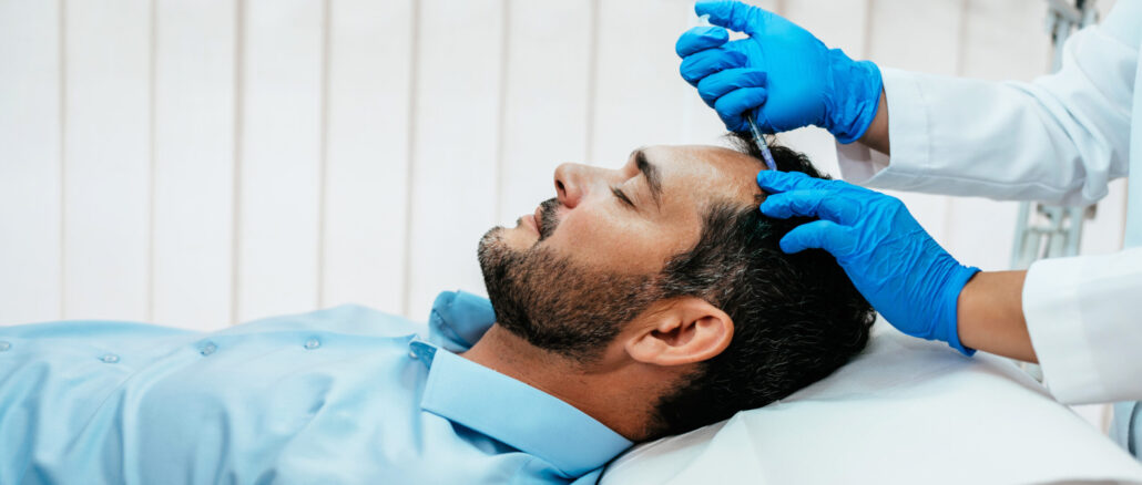 Mann liegt entspannt während einer medizinischen PRP Behandlung der Kopfhaut mit Injektion