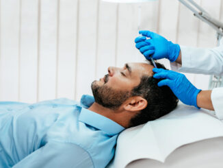 Mann liegt entspannt während einer medizinischen PRP Behandlung der Kopfhaut mit Injektion