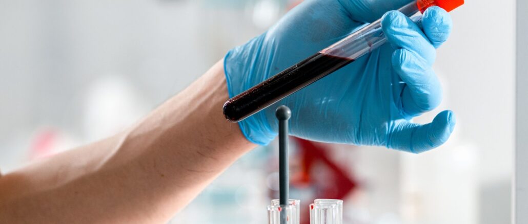 Wie lange ist Alkohol im Blut nachweisbar