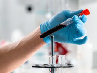 Wie lange ist Alkohol im Blut nachweisbar